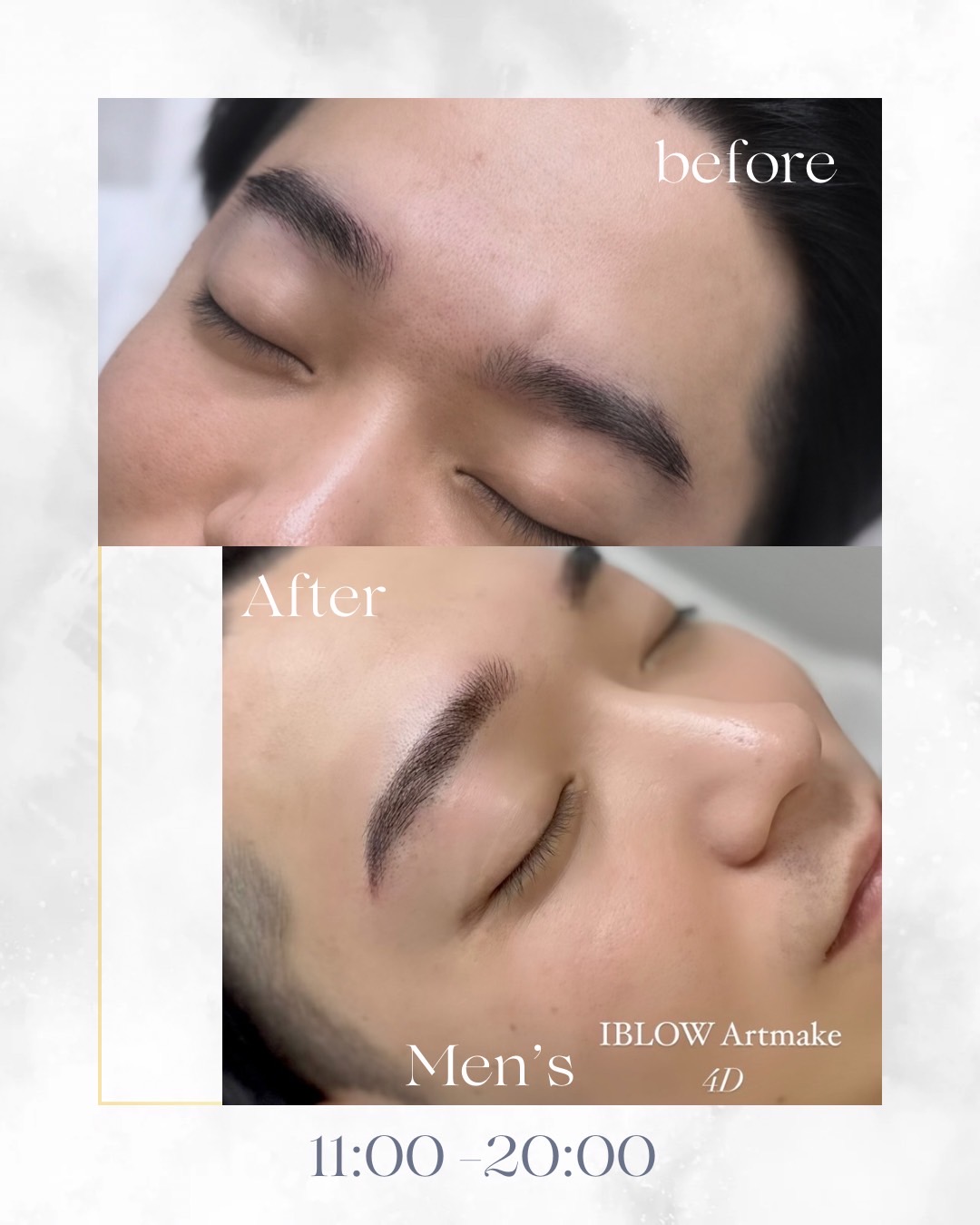 福岡 メンズ アートメイク