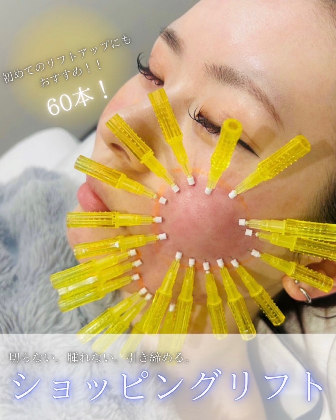 ショッピングリフト60本 施術イメージ