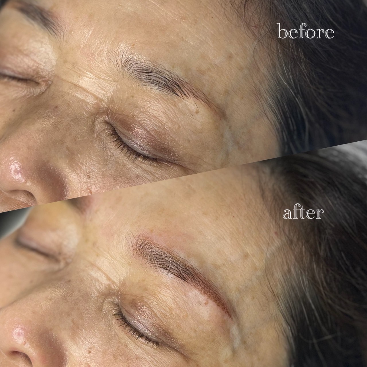 眉アートメイク症例