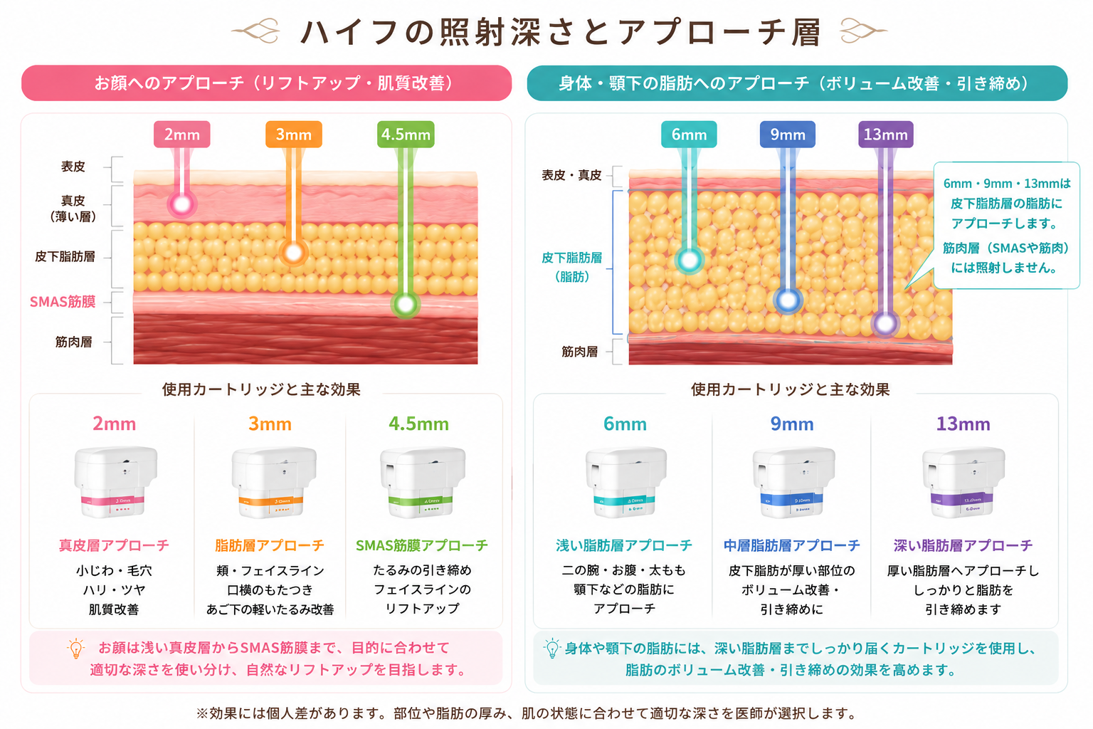 ハイフの深さ 1.5mm 3.0mm 4.5mm SMAS筋膜 真皮 皮下脂肪