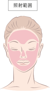 ニードルRFチップ