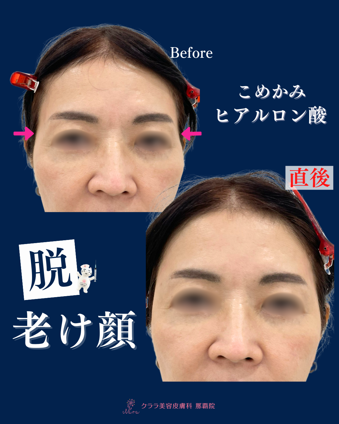 ほほ様ご確認ページ✨ けたたましく 