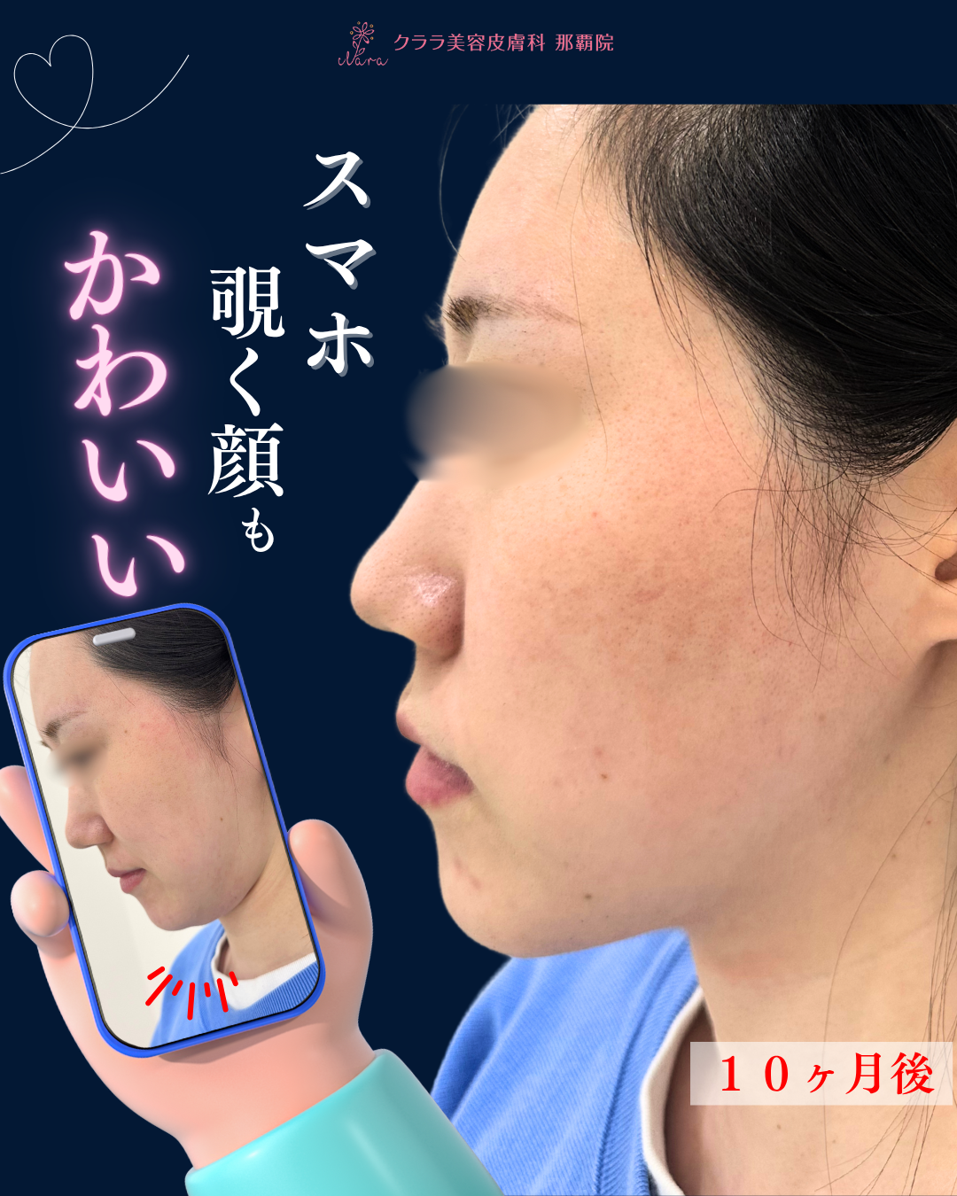 太っ て ない の に 二 重 アゴ