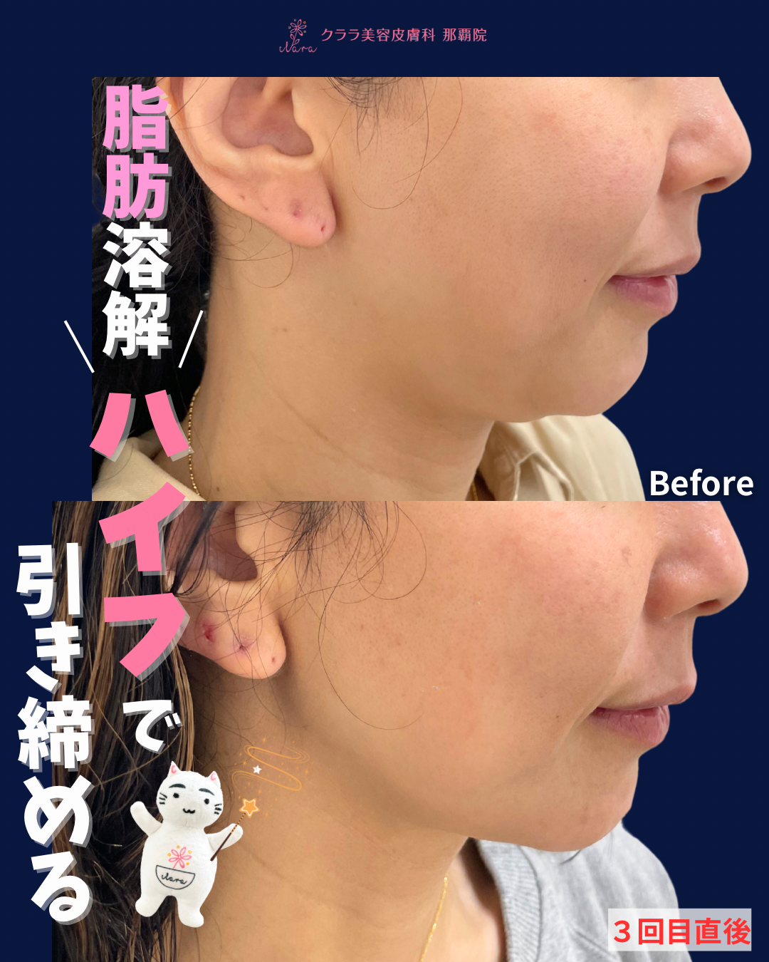 スライド③医療ハイフ