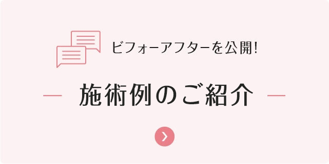 左バナー
