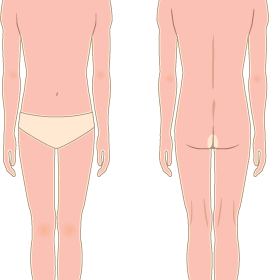 メンズ施術身体