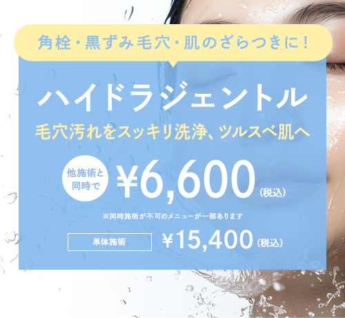 期間限定キャンペーン