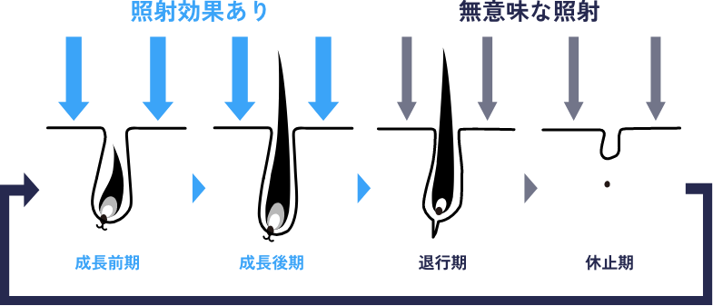 成長前期と成長後期に照射効果あり。退行期と休止期には無意味な照射。