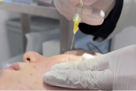 施術の基本的な流れ