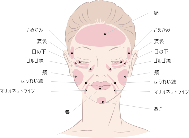 ヒアルロン酸注射 施術可能な箇所