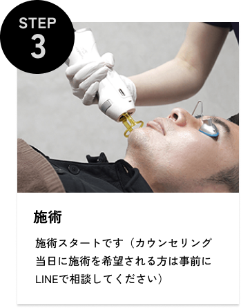 STEP3 施術 施術スタートです（カウンセリング当日に施術を希望される方は事前にLINEで相談してください）