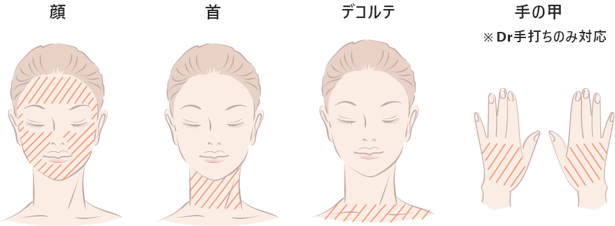 注入可能箇所