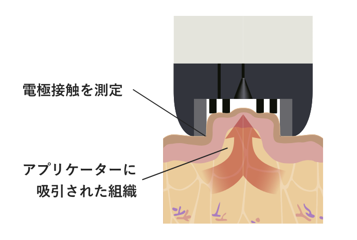 Vリフトのしくみ
