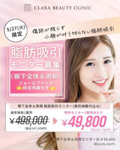 顔の脂肪吸引モニター募集