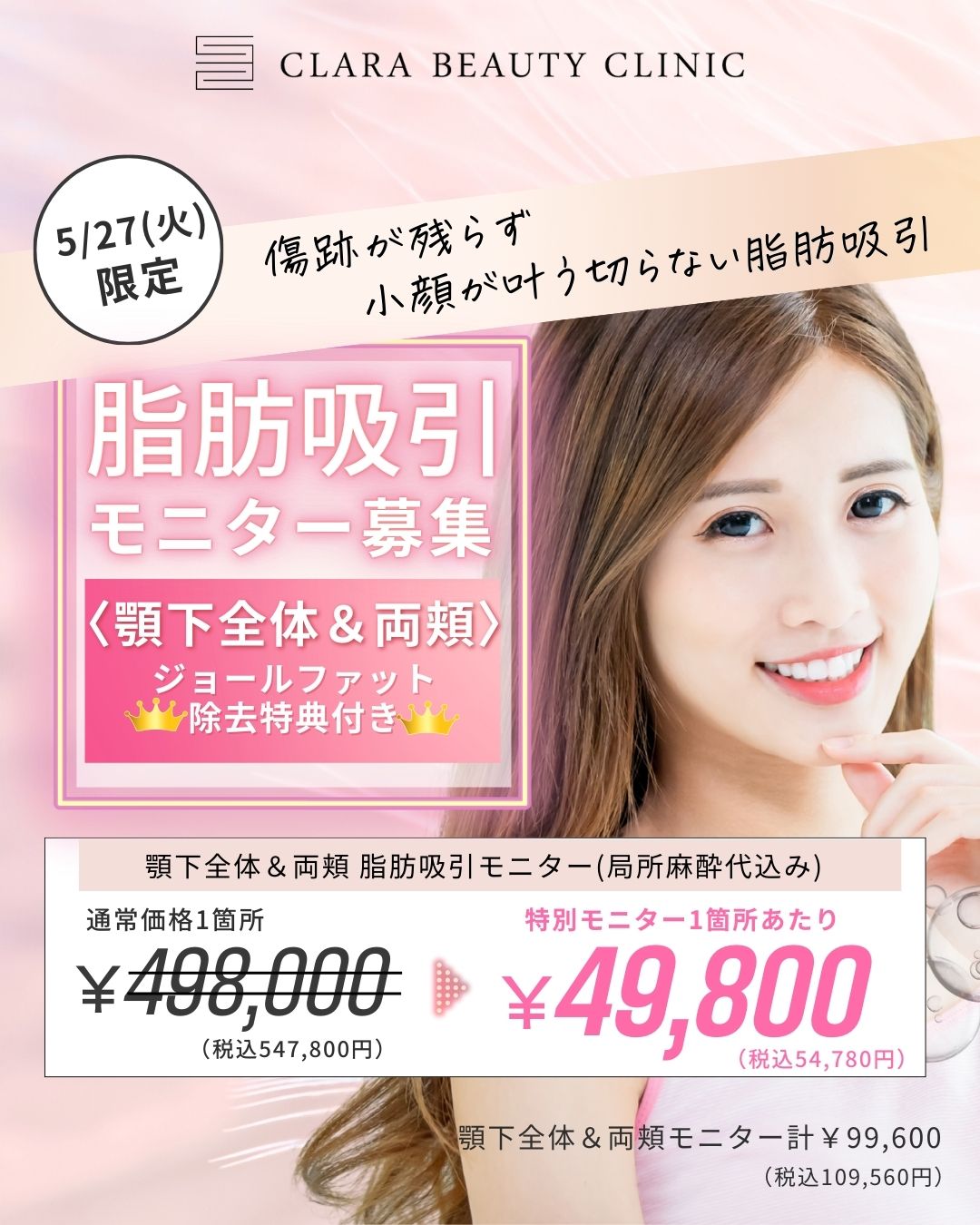 顔の脂肪吸引モニター募集