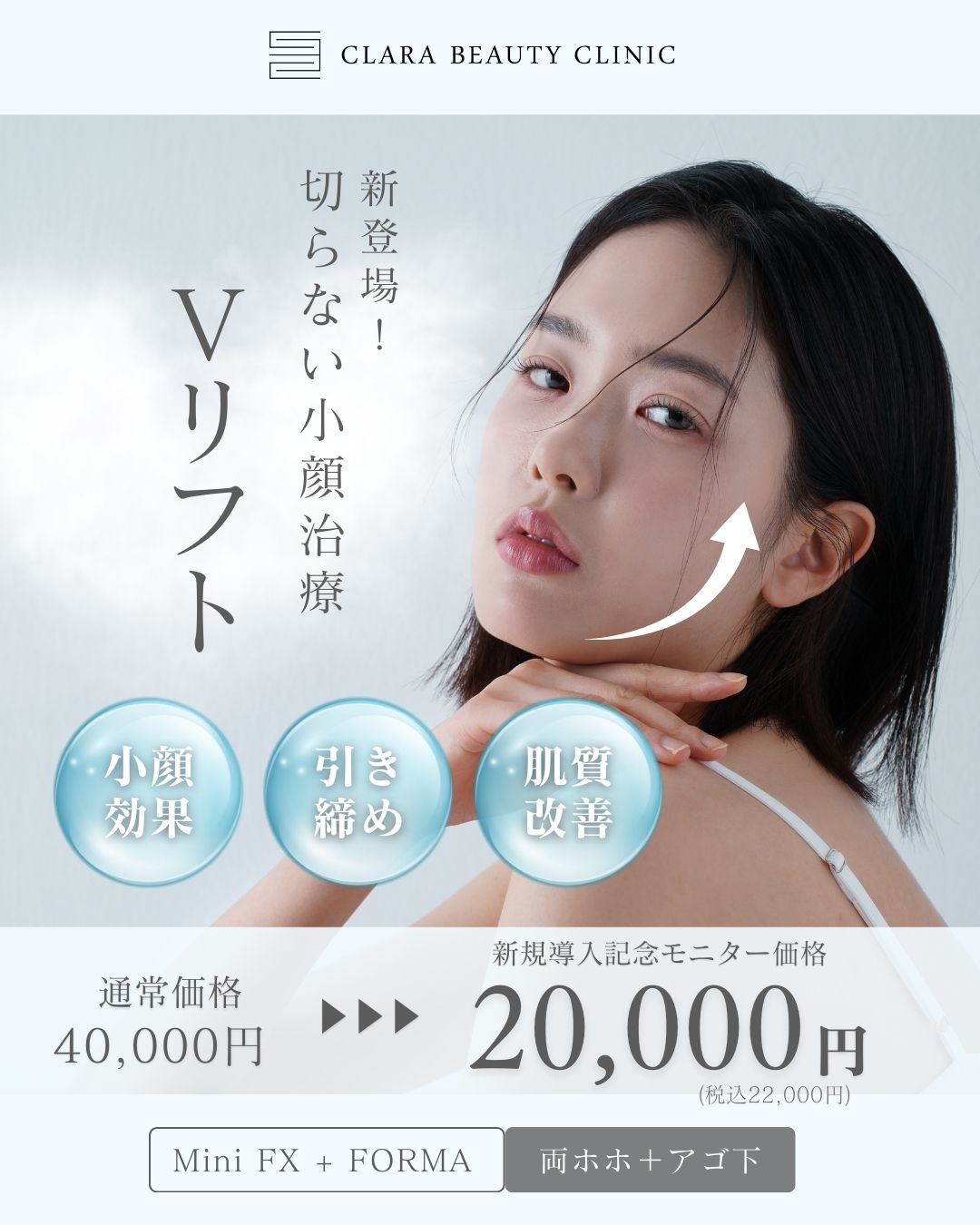 Vリフト導入