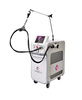 ロングパルスレーザー