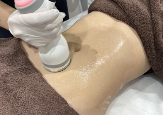 施術の基本的な流れ