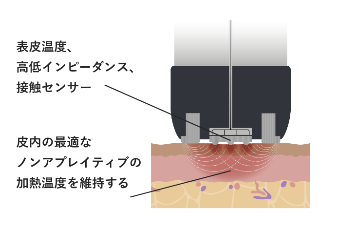 Vリフトのしくみ